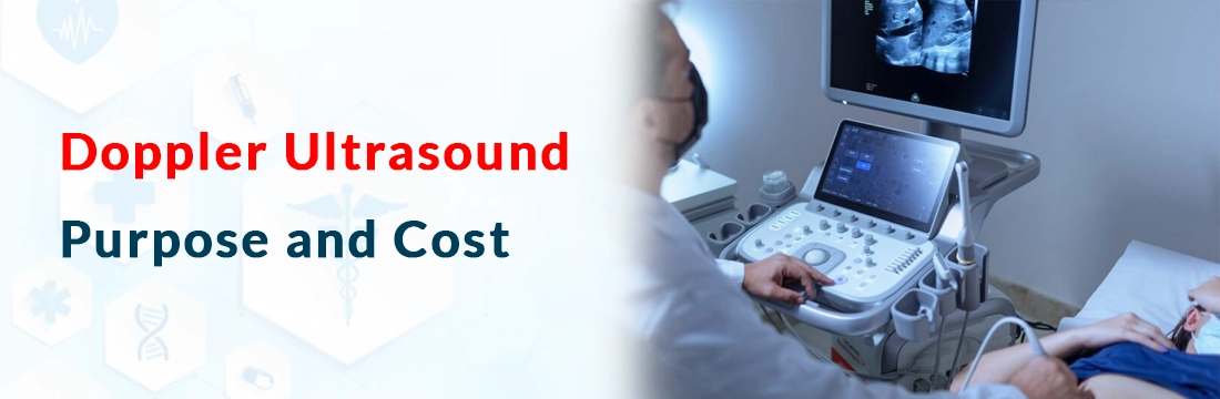 Doppler Ultrasound: Purpose and Cost in Delhi NCR